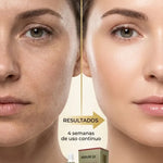 Combo ACIDO HIALURONICO 24K - Limpiador facial